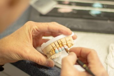Should You Go For Invisalign Treatment?