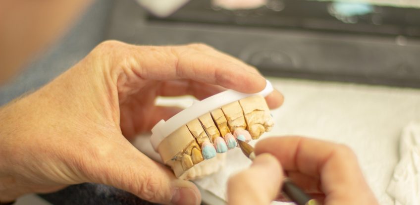 Should You Go For Invisalign Treatment?